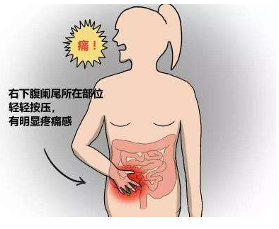 阑尾炎